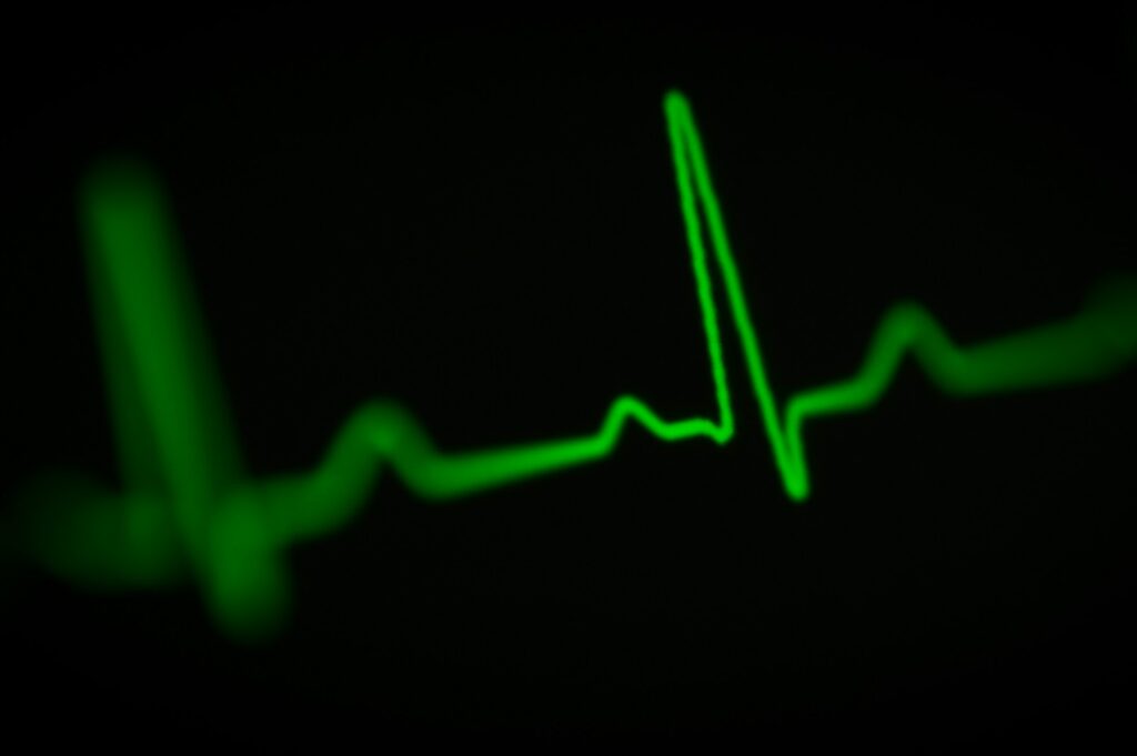 repeatable cardiac monitoring