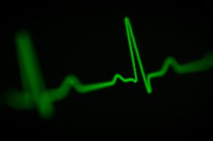 repeatable cardiac monitoring